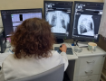 kobieta przegląda zdjęcia rtg płuc na monitorze
